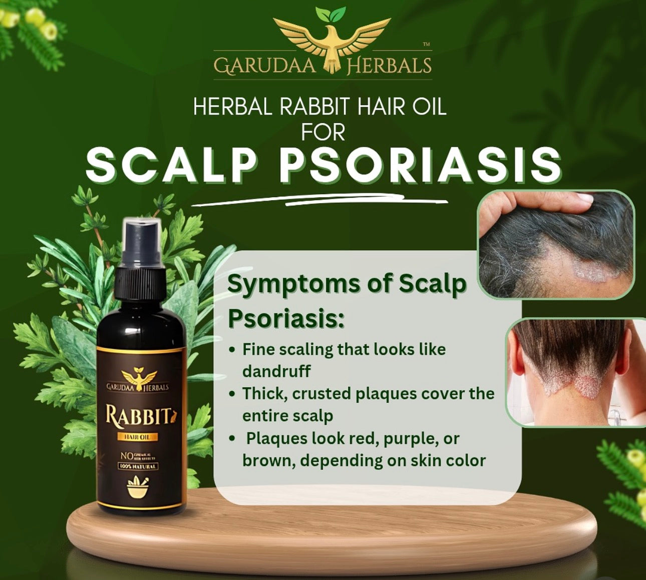 Rabit Herbal Hair Oil - 100% Effective!